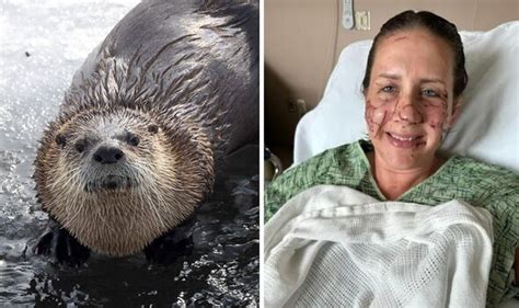 Woman hospitalized, 2 others injured in Montana otter attack